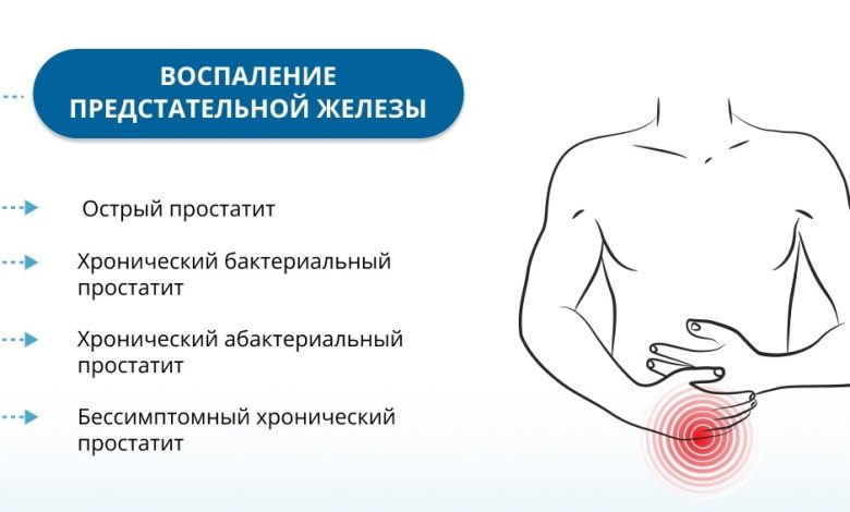 Photo of Симптомы острого простатита