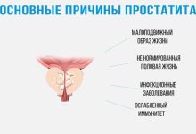 Photo of Основные признаки простатита
