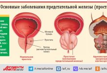 Photo of Как отличить простатит от других заболеваний?