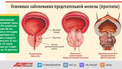 Photo of Как отличить простатит от других заболеваний?