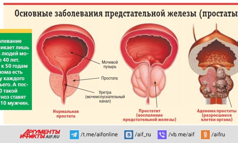 Photo of Как отличить простатит от других заболеваний?