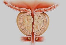 Photo of Простатит: какие стадии опаснее?