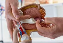 Photo of Как распознать стадию простатита?