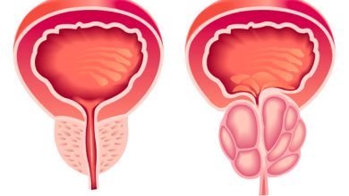 Photo of Как узнать о простатите?