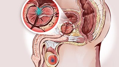 Photo of Что делает простатит опасным