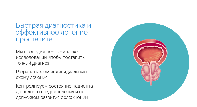 Photo of Эффективные методы лечения простатита